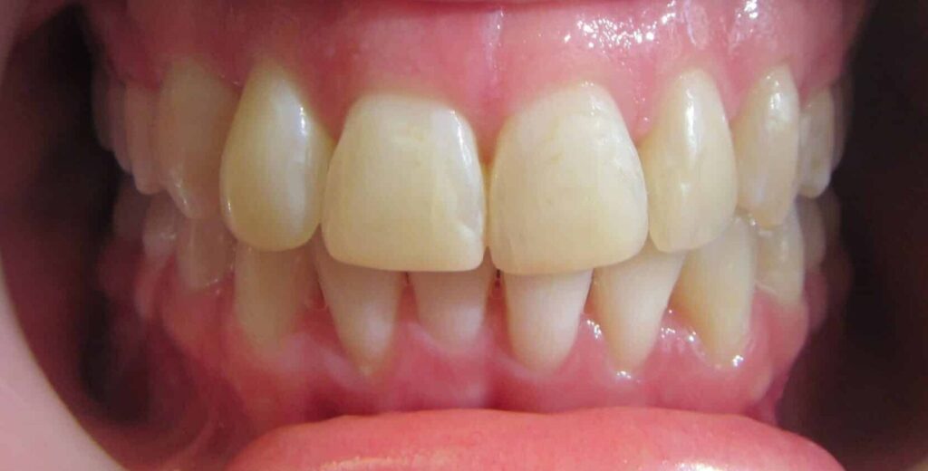 Smile Gallery. Dentist in Laguna Hills, CA. Dr. Marian Bradford, DDS. Premier Dental of South Orange County