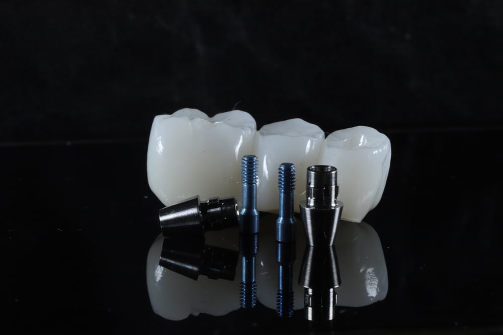Cosmetic Dentistry in Laguna Hills, CA. Dr. Marian Bradford, DDS. Premier Dental of South Orange County