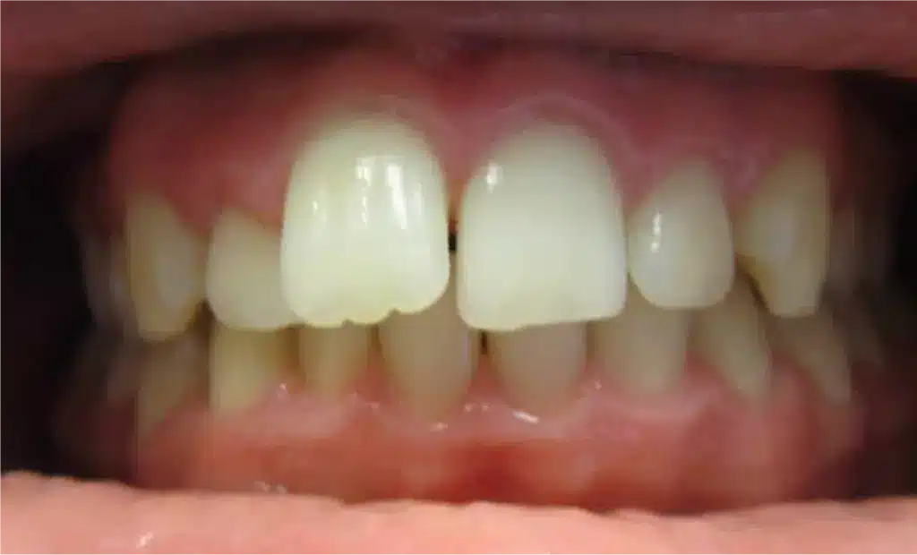 Smile Gallery. Dentist in Laguna Hills, CA. Dr. Marian Bradford, DDS. Premier Dental of South Orange County