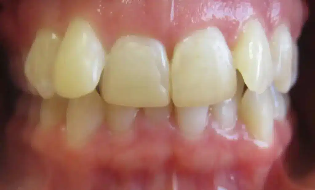 Smile Gallery. Dentist in Laguna Hills, CA. Dr. Marian Bradford, DDS. Premier Dental of South Orange County